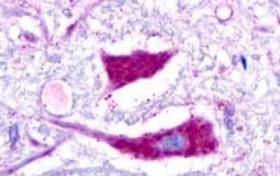 Immunohistochemistry: Galanin R3/GALR3 Antibody [NBP3-14329]